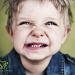 دندان قروچه در کودکان (Bruxism)